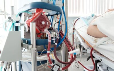 Diagram showing ECMO machine supporting heart and lung function