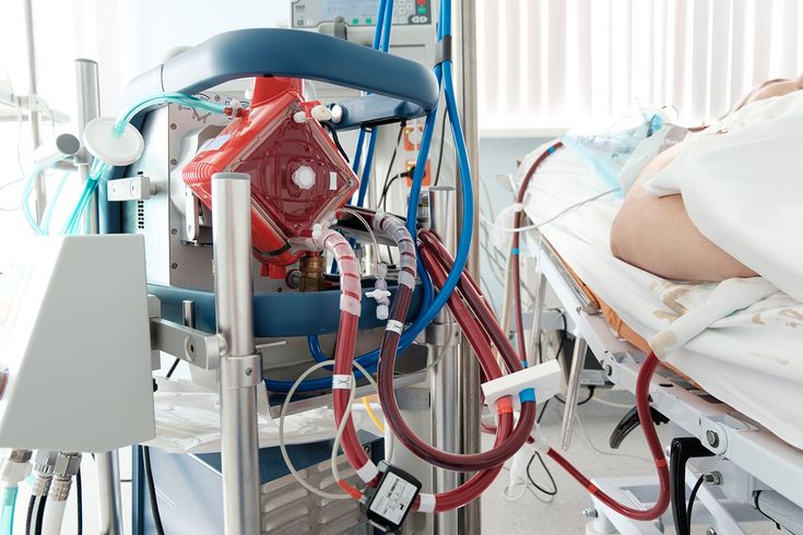 Diagram showing ECMO machine supporting heart and lung function